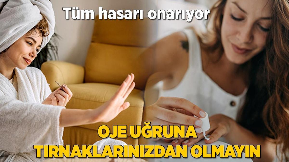 Oje uğruna mahvolan tırnakların kurtarıcısı! Sadece damlatın, tüm hasarı onarıyor